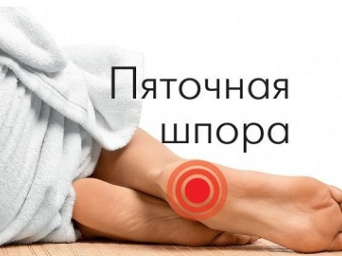 Масажер для п'яткової шпори